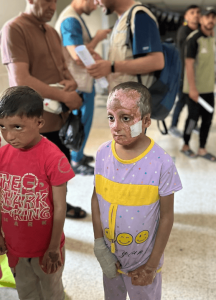 Children from the same family suffered burns from a home explosion. The children stand in the hospital with melted skin after losing their home.